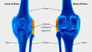 Read more about the article Lateral Collateral Ligament Exercises: Strengthening and Rehabilitation